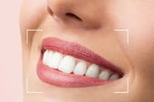 Picture for category  Tooth Polisher, Whitening